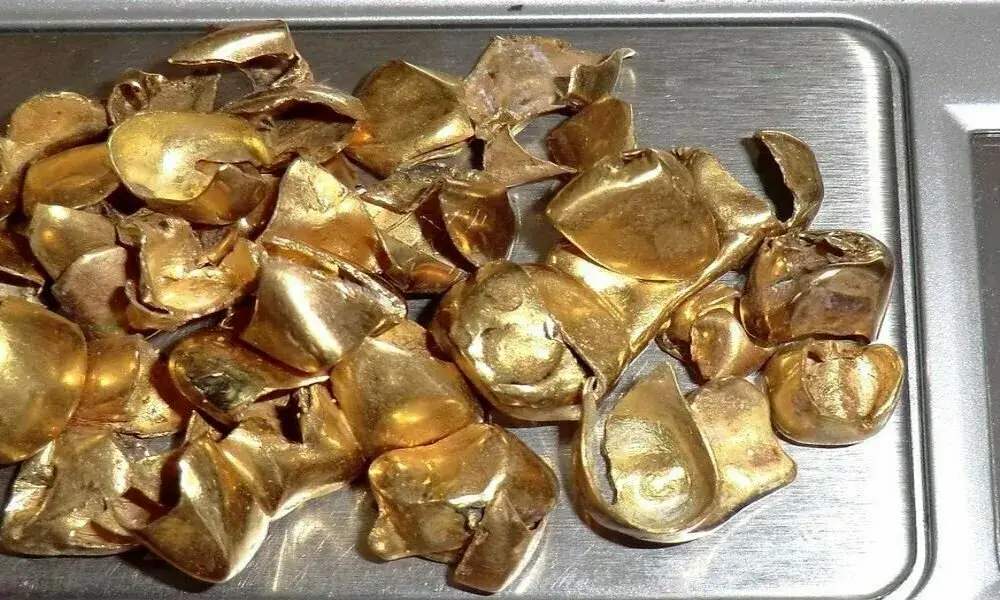 Зубные коронки из драгметаллов